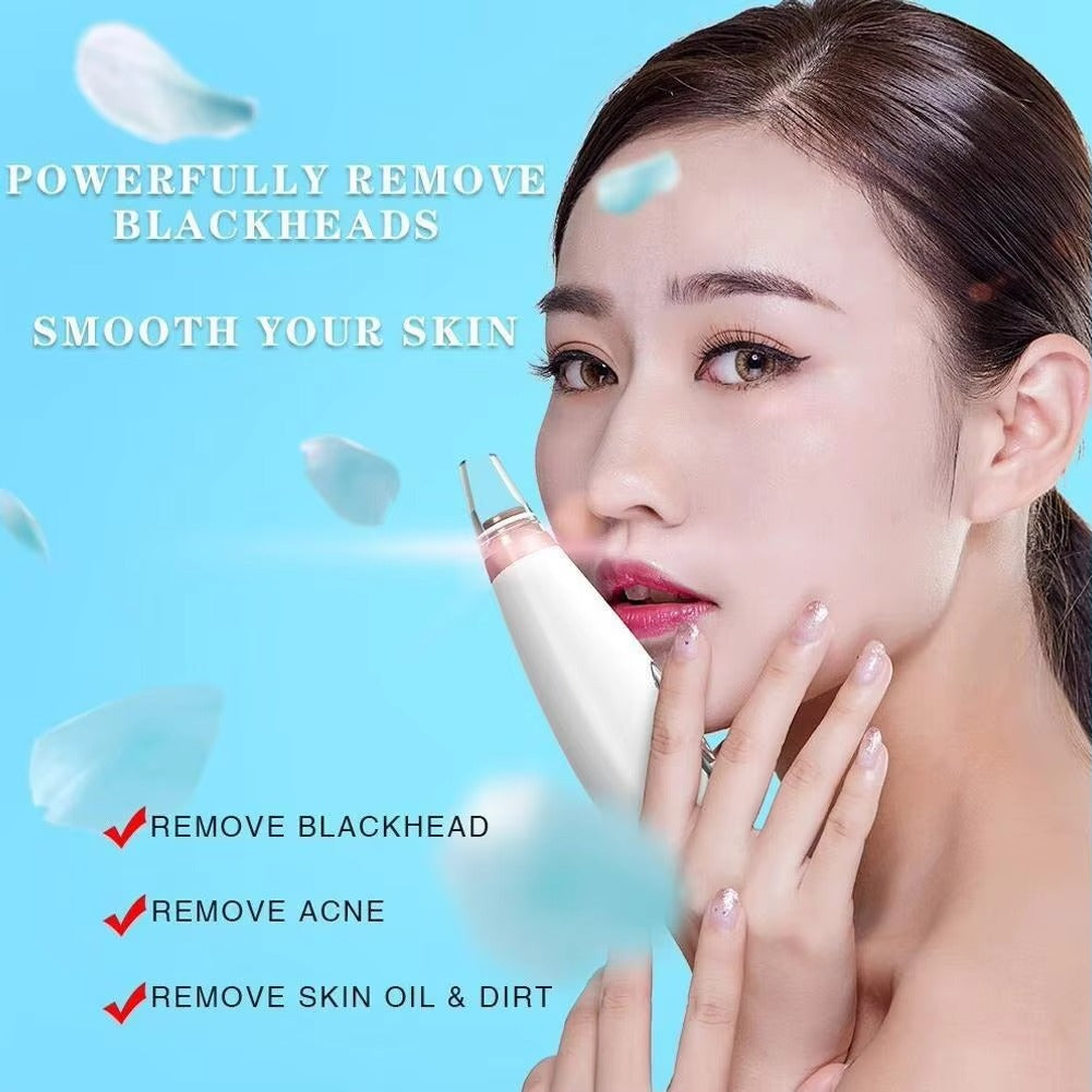 6-in-1 Blackhead Remover Vacuum